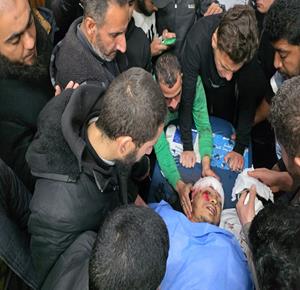 وصول شهيد وعدد من المصابين إلى مجمع ناصر الطبي جراء استهداف طائرة استطلاع إسرائيلية خيمة تؤوي نازحين في خان يونس جنوب قطاع غزة