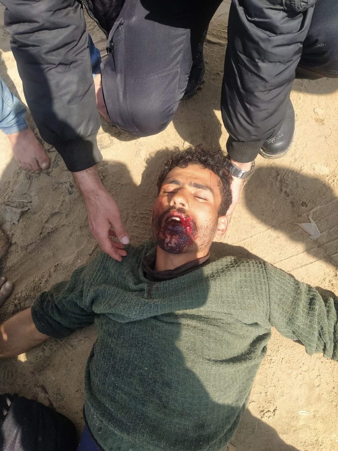 أحد الصيادين المصابين