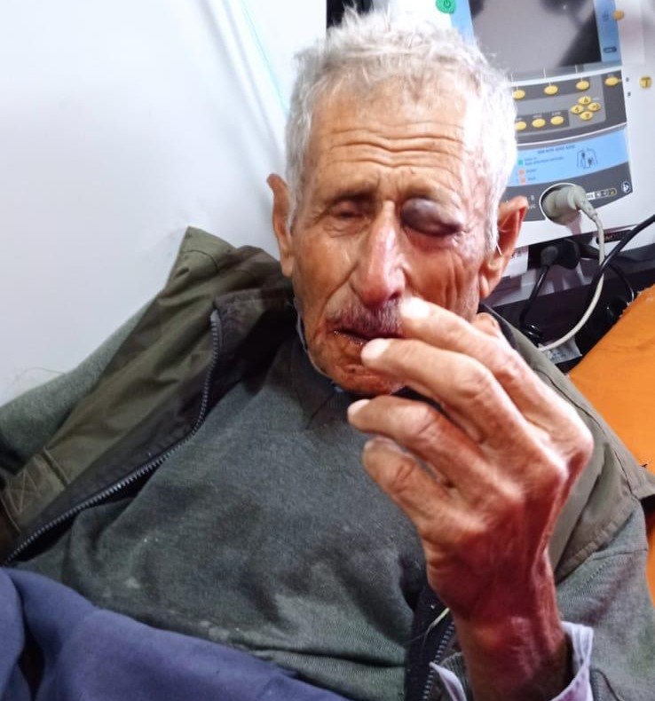 المسن محمود فقها بعد الاعتداء عليه من قبل المستوطنين