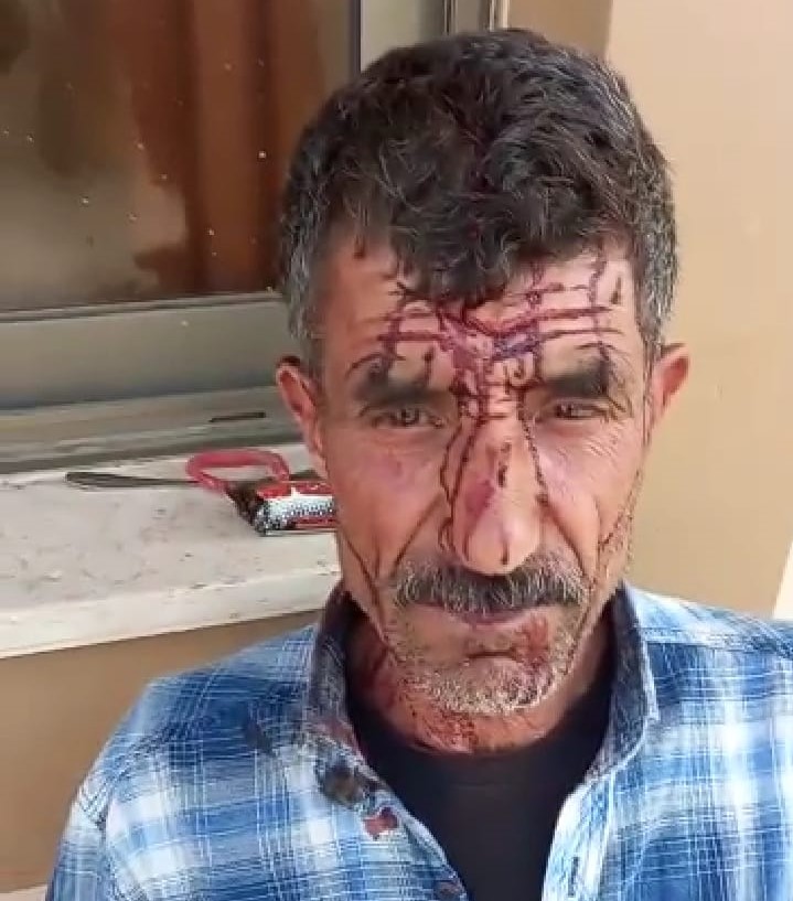 مستوطنون يعتدون على راعي أغنام ويصيبونه بجروح جنوب غرب جنين