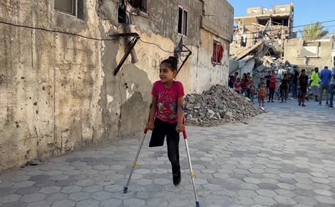  الطفلة ميرال تحلم بطرف صناعي 