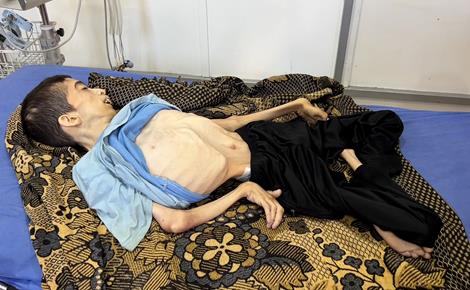 التجويع في غزة يودي بحياة الشاب كرم الجمل