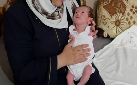 الرضيعة نور عيد الجواد وُلدت بلا يدين