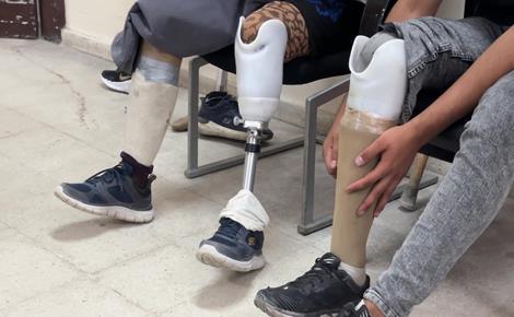 عمل متواصل في مركز الأطراف الصناعية بغزة 