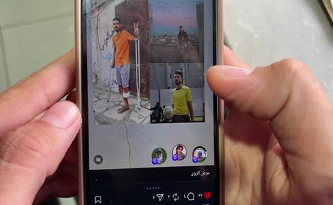 رمضان فقد ساقه ويصرّ على العمل والحياة