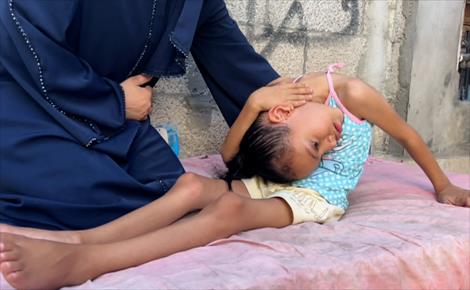 سيلا تنتظر علاجاً خارج غزة بعد إصابتها بالعمود الفقري 